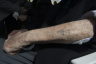 Kounio: Heinz: Holocaust Number Tattoo